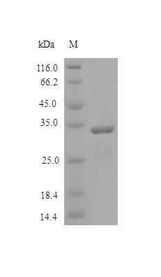 Recombinant Human SPARC protein(SPARC),partial (Active)