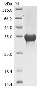 Recombinant Human SPRY domain-containing SOCS box protein 1(SPSB1)