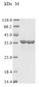 Recombinant Human SPRY domain-containing SOCS box protein 1(SPSB1)