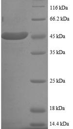 Recombinant Human SUMO-conjugating enzyme UBC9(UBE2I),partial