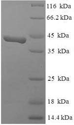 Recombinant Human SWI/SNF complex subunit SMARCC1(SMARCC1) ,partial