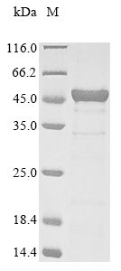 Recombinant Human SWI/SNF-related matrix-associated actin-dependent regulator of chromatin subfamily B member 1(SMARCB1),partial
