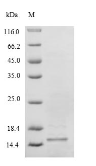 Recombinant Human Selenoprotein M(SELM)