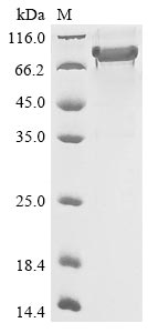 Recombinant Human Semaphorin-3B(SEMA3B)