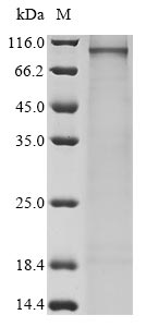 Recombinant Human Semaphorin-3G(SEMA3G)