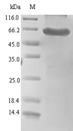 Recombinant Human Serine protease HTRA1(HTRA1)