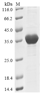 Recombinant Human Serine/threonine-protein kinase N1(PKN1),partial