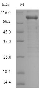 Recombinant Human Serine/threonine-protein kinase PAK 1(PAK1)