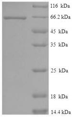 Recombinant Human Serine/threonine-protein kinase STK11(STK11)