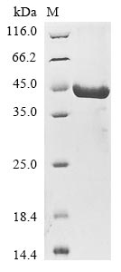 Recombinant Human Sestrin-3(SESN3)