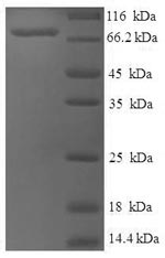 Recombinant Human Set1/Ash2 histone methyltransferase complex subunit ASH2(ASH2L)