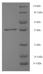 Recombinant Human Single-strand selective monofunctional uracil DNA glycosylase(SMUG1)
