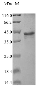 Recombinant Human Small kinetochore-associated protein(KNSTRN)