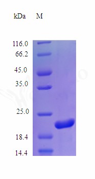 Recombinant Human Somatotropin protein(GH1) (Active)