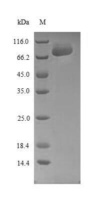 Recombinant Human Sprouty-related, EVH1 domain-containing protein 1(SPRED1)