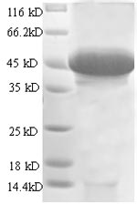 Recombinant Human Stanniocalcin-1(STC1),partial
