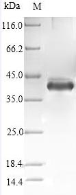 Recombinant Human Stanniocalcin-1(STC1),partial