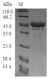 Recombinant Human Stathmin-4(STMN4)