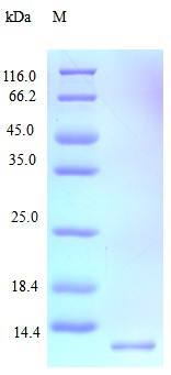 Recombinant Human Stromal cell-derived factor 1 protein(CXCL12),partial (Active)