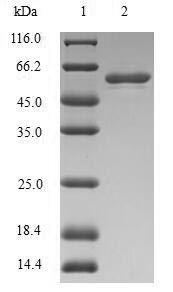 Recombinant Human Stromelysin-1(MMP3),partial