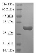 Recombinant Human Substance-P receptor(TACR1),partial