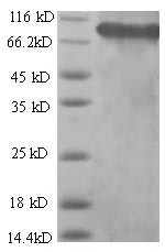 Recombinant Human Succinate dehydrogenase [ubiquinone] flavoprotein subunit, mitochondrial(SDHA),partial