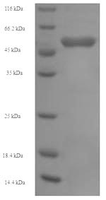 Recombinant Human Succinyl-CoA:3-ketoacid-coenzyme A transferase 1, mitochondrial(OXCT1)