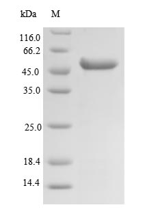 Recombinant Human Succinyl-CoA ligase [GDP-forming] subunit beta, mitochondrial(SUCLG2),partial