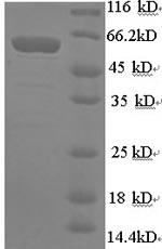 Recombinant Human Synapsin-1(SYN1) ,partial