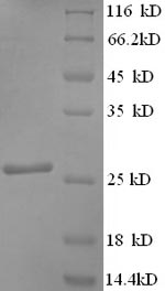 Recombinant Human Synaptosomal-associated protein 25(SNAP25)