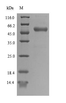 Recombinant Human T-cell antigen CD7(CD7),partial (Active)