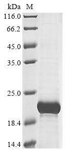 Recombinant Human T cell receptor beta constant 2(TRBC2),partial