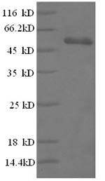 Recombinant Human T-cell surface glycoprotein CD3 epsilon chain(CD3E) 