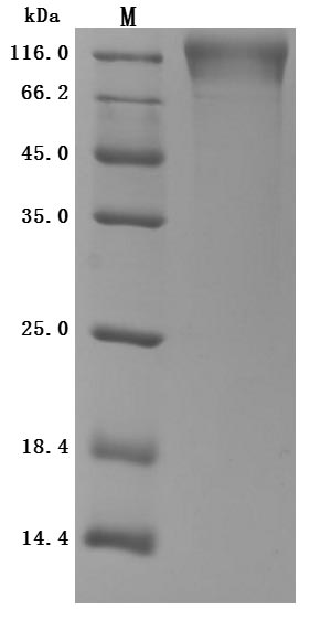 Recombinant Human T-cell surface protein tactile(CD96),partial (Active)