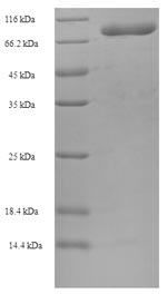 Recombinant Human T-complex protein 1 subunit beta(CCT2)