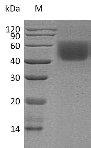 Recombinant Human T-lymphocyte activation antigen CD86(CD86),partial (Active)