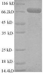 Recombinant Human TNF receptor-associated factor 6(TRAF6)