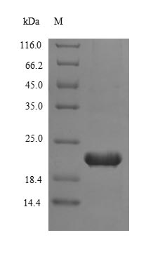 Recombinant Human Telomerase reverse transcriptase(TERT),partial