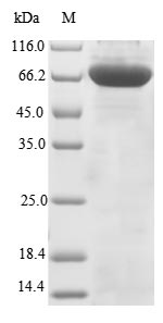 Recombinant Human Terminal nucleotidyltransferase 4B(TENT4B)