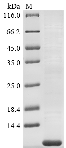 Recombinant Human Tetraspanin-2(TSPAN2),partial