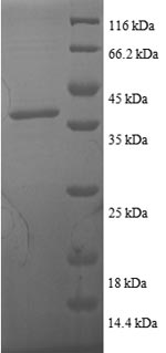 Recombinant Human Thioredoxin(TXN)