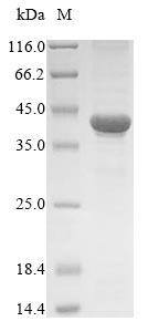 Recombinant Human Thioredoxin domain-containing protein 5(TXNDC5)