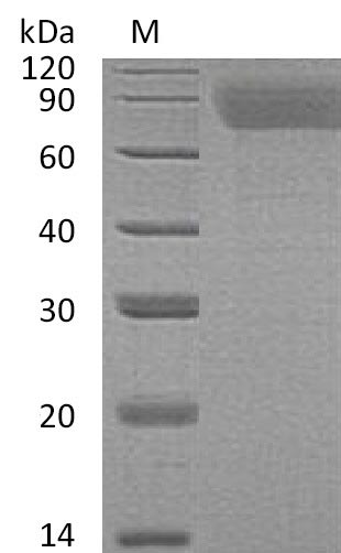Recombinant Human Thrombopoietin(THPO) (Active)
