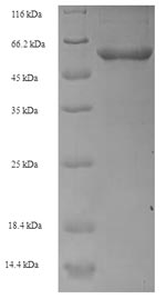Recombinant Human Transcobalamin-1(TCN1)