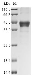 Recombinant Human Transcription factor SOX-2(SOX2)(M317MC)
