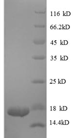 Recombinant Human Transforming growth factor beta-1(TGFB1),partial