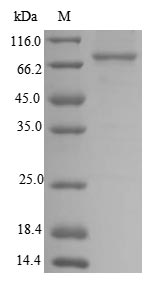 Recombinant Human Transforming growth factor beta activator LRRC33(NRROS),partial
