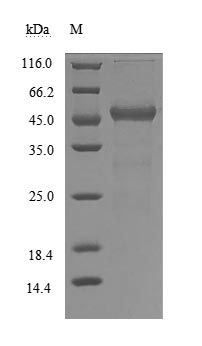 Recombinant Human Transthyretin(TTR) (Active)
