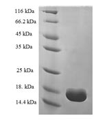 Recombinant Human Transthyretin(TTR)