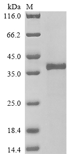 Recombinant Human Tripeptidyl-peptidase 2(TPP2),partial